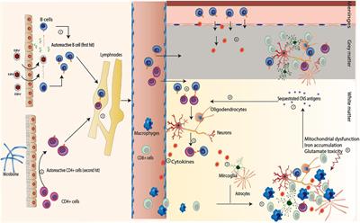 Primary Progressive Multiple Sclerosis: Putting Together the Puzzle